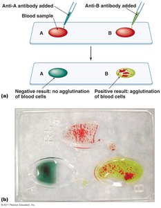 Hemagglutination for blood typing