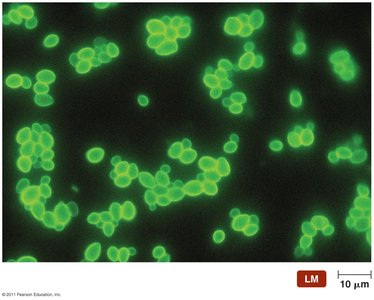 Direct fluorescent antibody test