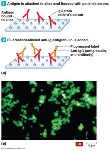 Indirect fluorescent antibody test