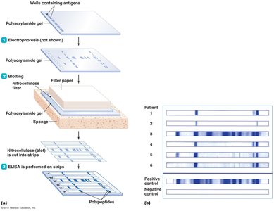 Western blot test steps and results