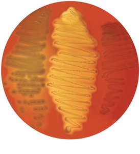 Blood agar showing alpha, beta, and gamma hemolysis