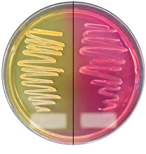 Mannitol salt agar showing fermentation results