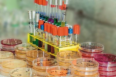 Assortment of culture media in tubes and petri dishes
