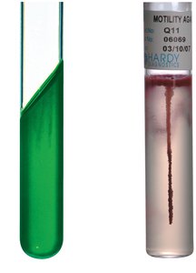 Simmons citrate test and motility test in tubes