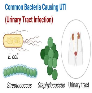 Growth patterns in thioglycollate broth
