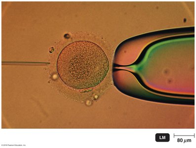 Microinjection of DNA into an egg cell