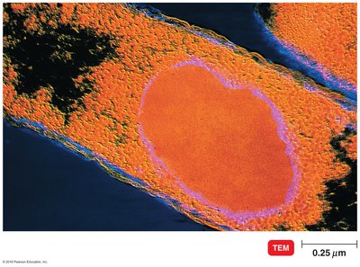Genetically modified E. coli producing human protein