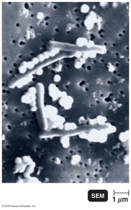 Bacillus cells forming elemental selenium chains