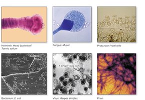 Six types of microorganisms