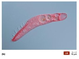Ciliated protozoan
