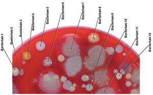 Bacterial colonies on agar plate