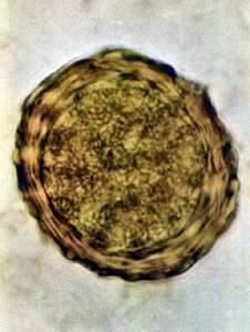Ascaris lumbricoides egg with characteristic bumpy surface