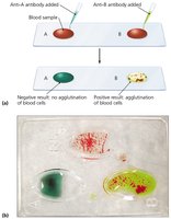 Agglutination test for blood typing