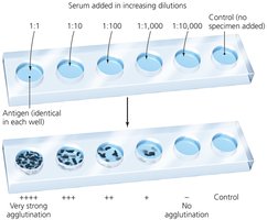 Agglutination titration test