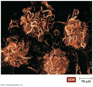 Cytoplasmic membrane extensions in hairy-cell leukemia
