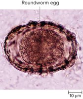 Roundworm egg under microscope