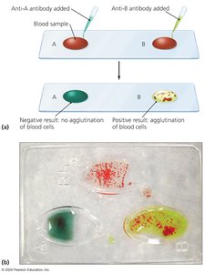 Agglutination test for blood typing