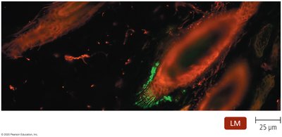 Direct fluorescent immunoassay micrograph