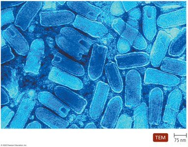 Rabies virus TEM