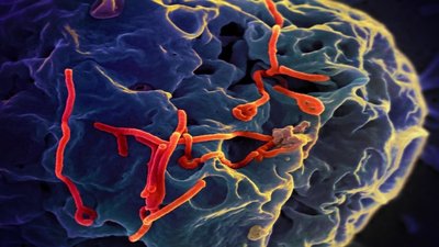 Ebola virus TEM