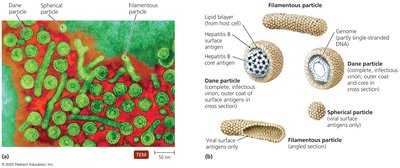 Three types of HBV particles: Dane, spherical, filamentous