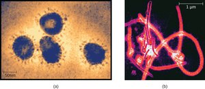 Viruses under electron microscope