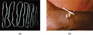 Helminth parasites