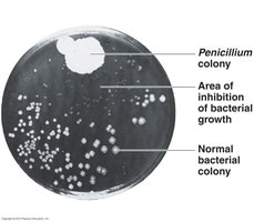 Discovery of penicillin