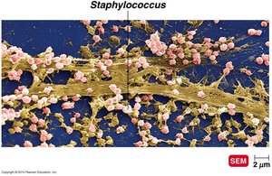 Biofilm structure