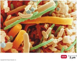 Emerging infectious diseases