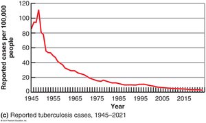 Epidemiological Graphs: Tuberculosis cases over time