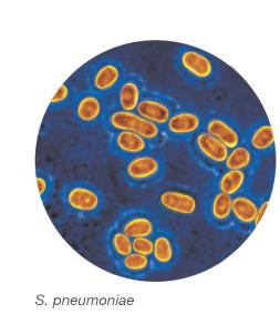 S. pneumoniae under microscope