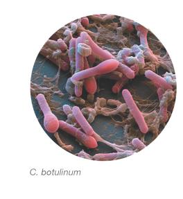 C. botulinum under microscope