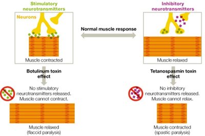 Comparison of botulinum and tetanospasmin toxin effects