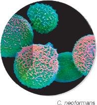 C. neoformans under microscope