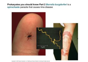 Emerging infectious disease and vectors