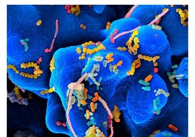 Microbial community interactions