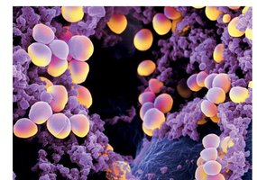 Staphylococcus aureus and oral flora
