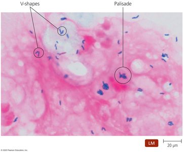 Corynebacterium V-shapes and palisade arrangements under light microscopy