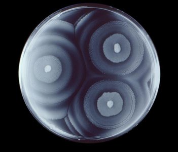 Proteus swarming on agar plate
