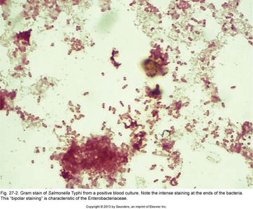 Gram stain of Salmonella Typhi showing bipolar staining