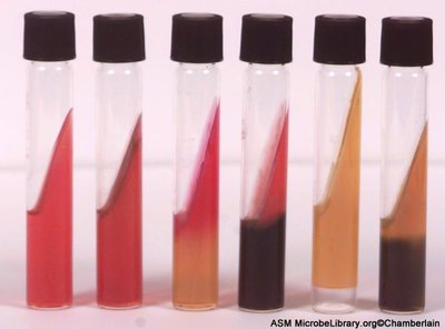 TSI agar slants showing different fermentation patterns