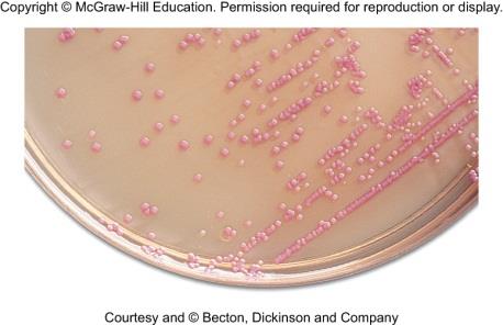 Coliforms on MacConkey agar (pink colonies)