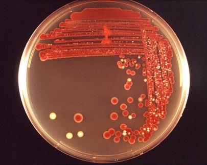Serratia marcescens red colonies on agar