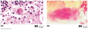 Inclusion bodies in virus-infected cells