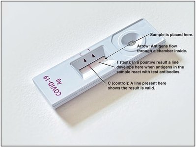 Steps of a direct ELISA test