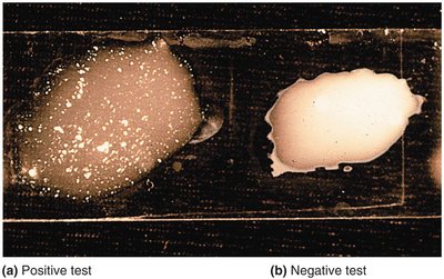 Slide agglutination test: positive and negative results