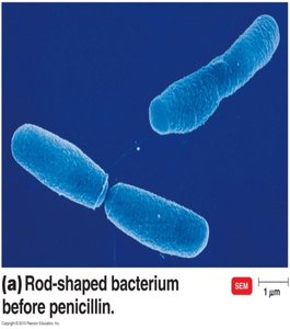 Rod-shaped bacterium before penicillin