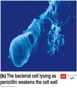 Bacterial cell lysing after penicillin treatment