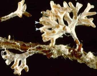 Ectomycorrhizal root structure